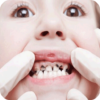 How to Heal Cavities Naturally icon