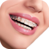 Real Braces Camera icon