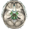 CT Scan Cross Sectional Anatomy for Imaging Pros icon