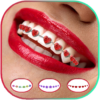 Real Teeth Braces Camera icon