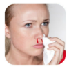 Nose Bleeding Remedies icon