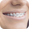 Teeth Braces Photo editor icon