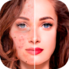 Anti Blemish Face Editor App icon