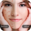 Face Blemish Remover Smooth icon