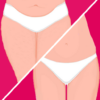 Cellulite removal buttocks workout icon