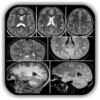 Imaging Brain, Skull & Craniocervical Vasculature icon