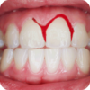 How To Stop Bleeding Gums icon