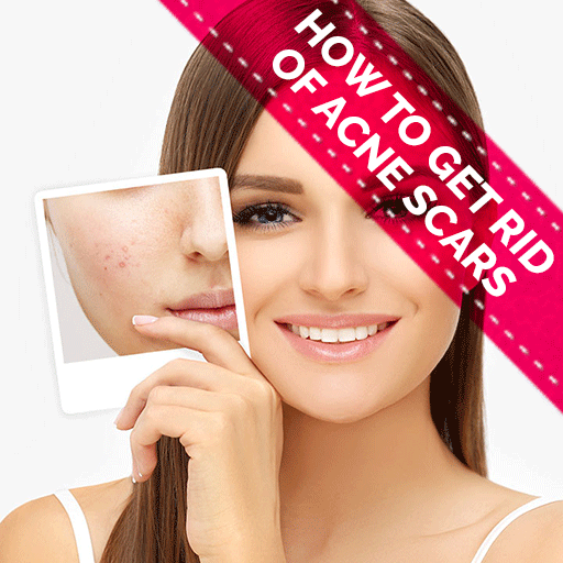 How to Get Rid of Acne Scars icon