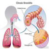 All respiratory disorder icon