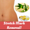 STRETCH MARK REMOVAL icon